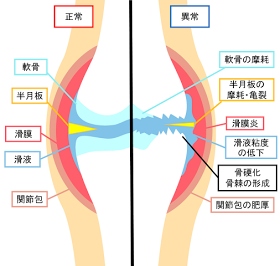 宗像整体−福津整体−膝痛−変形性膝関節症